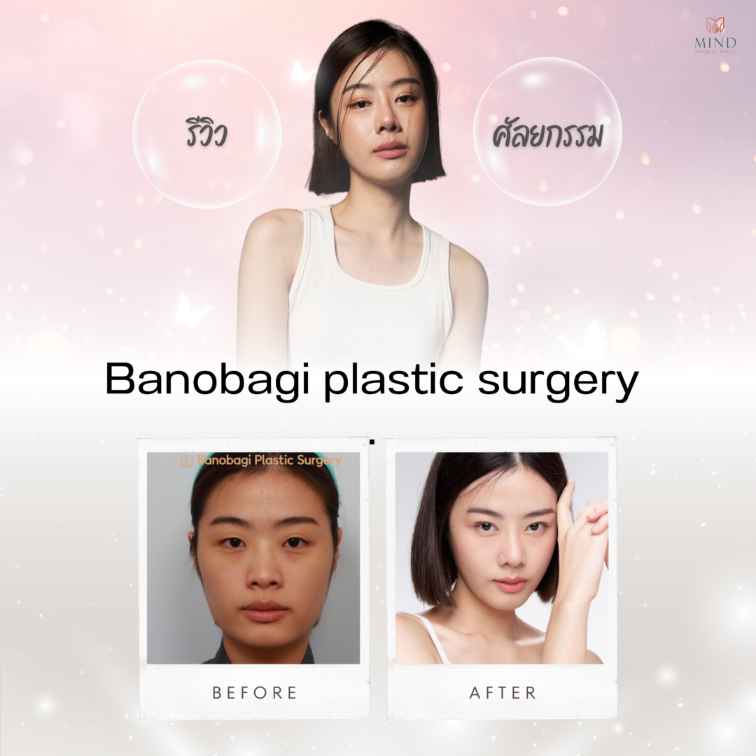 https://www.mindsurgerykorea.com/wp-content/uploads/2023/12/3_qBHbet_0-1080x1080.png