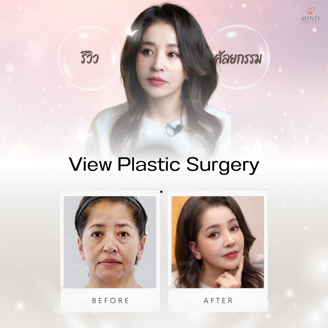 https://www.mindsurgerykorea.com/wp-content/uploads/2023/12/4_LjhecU_0-1080x1080.png