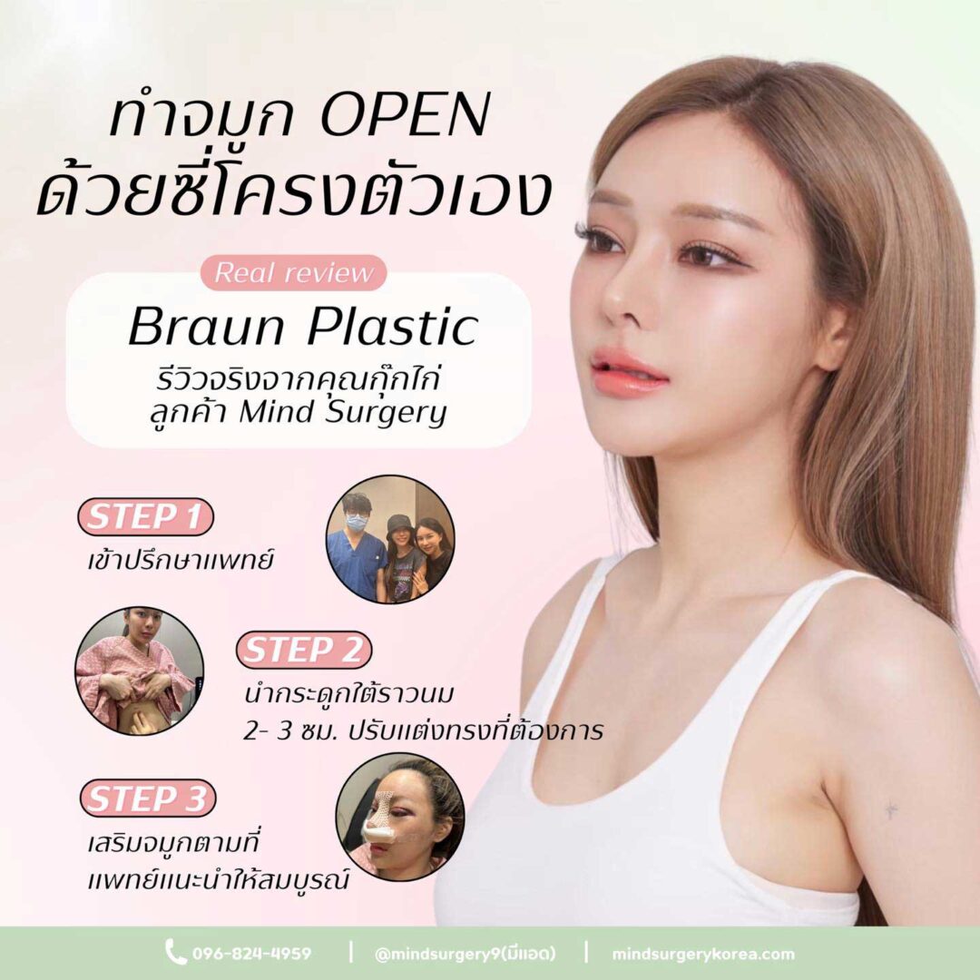 https://www.mindsurgerykorea.com/wp-content/uploads/2024/05/คุณกุ๊กไก่-บราวน์-1080x1080.jpg